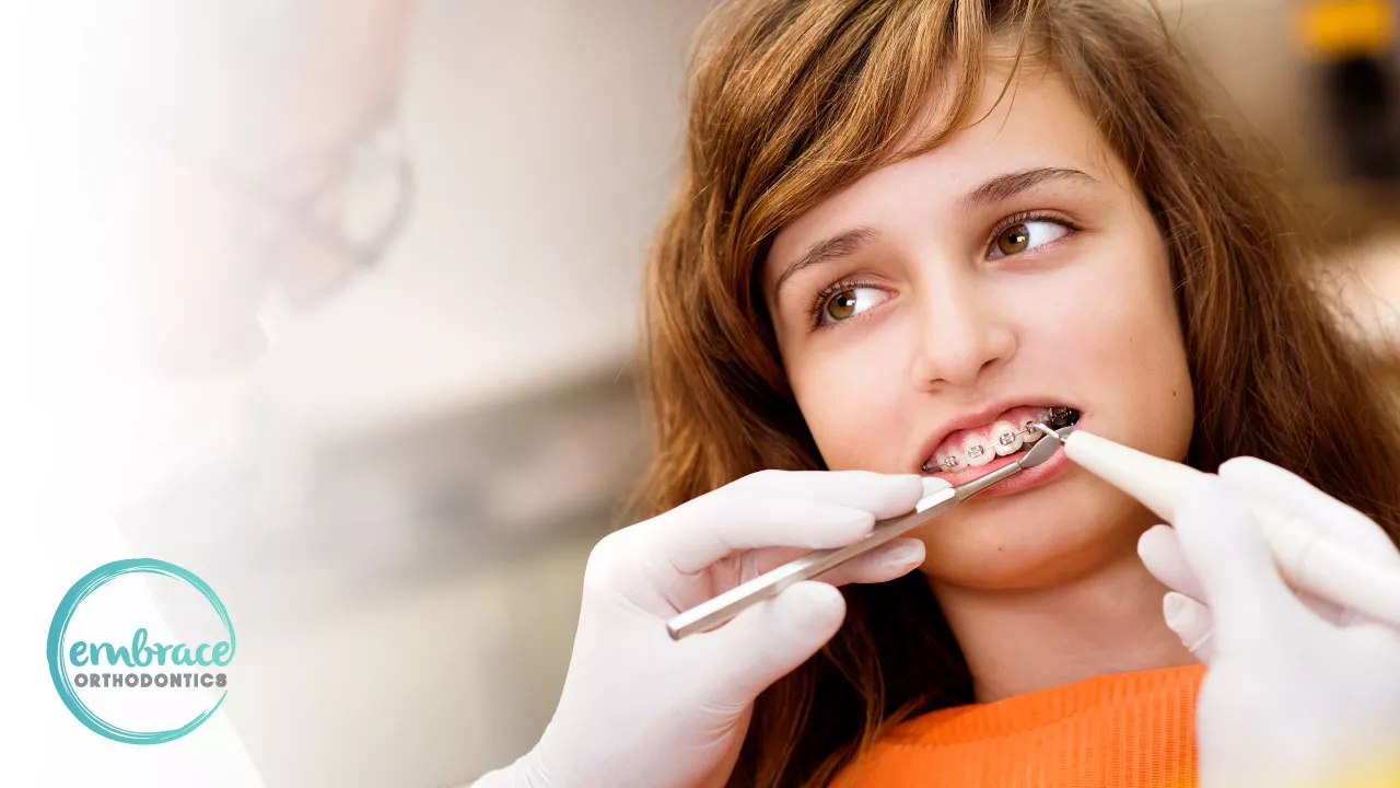 Interceptive Orthodontic Treatment: Why is Early Orthodontic Treatment Important?